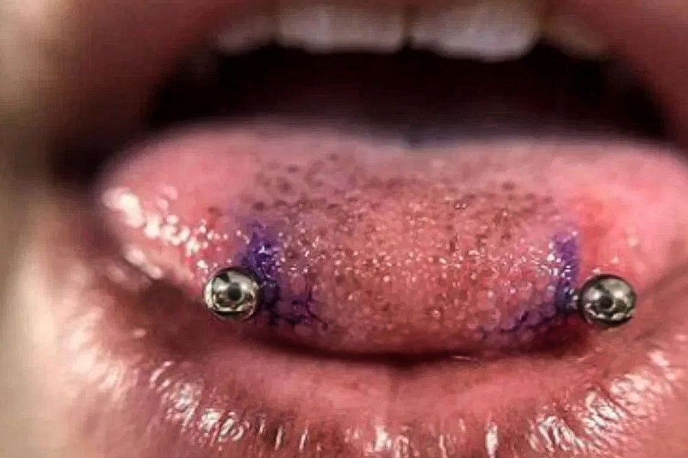 A women showing her new snake bite piercings.